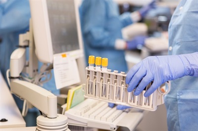 Analyzers and Analytical Instruments