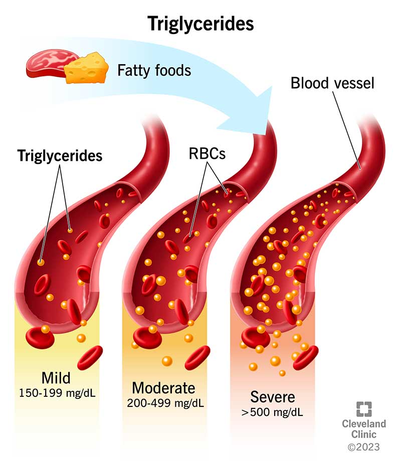 Triglyceride