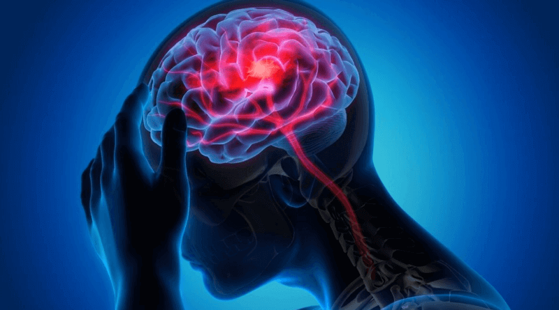 Neurology Treatment