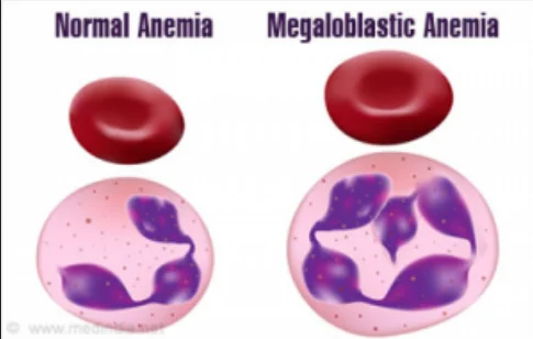 Anemia Treatment Service