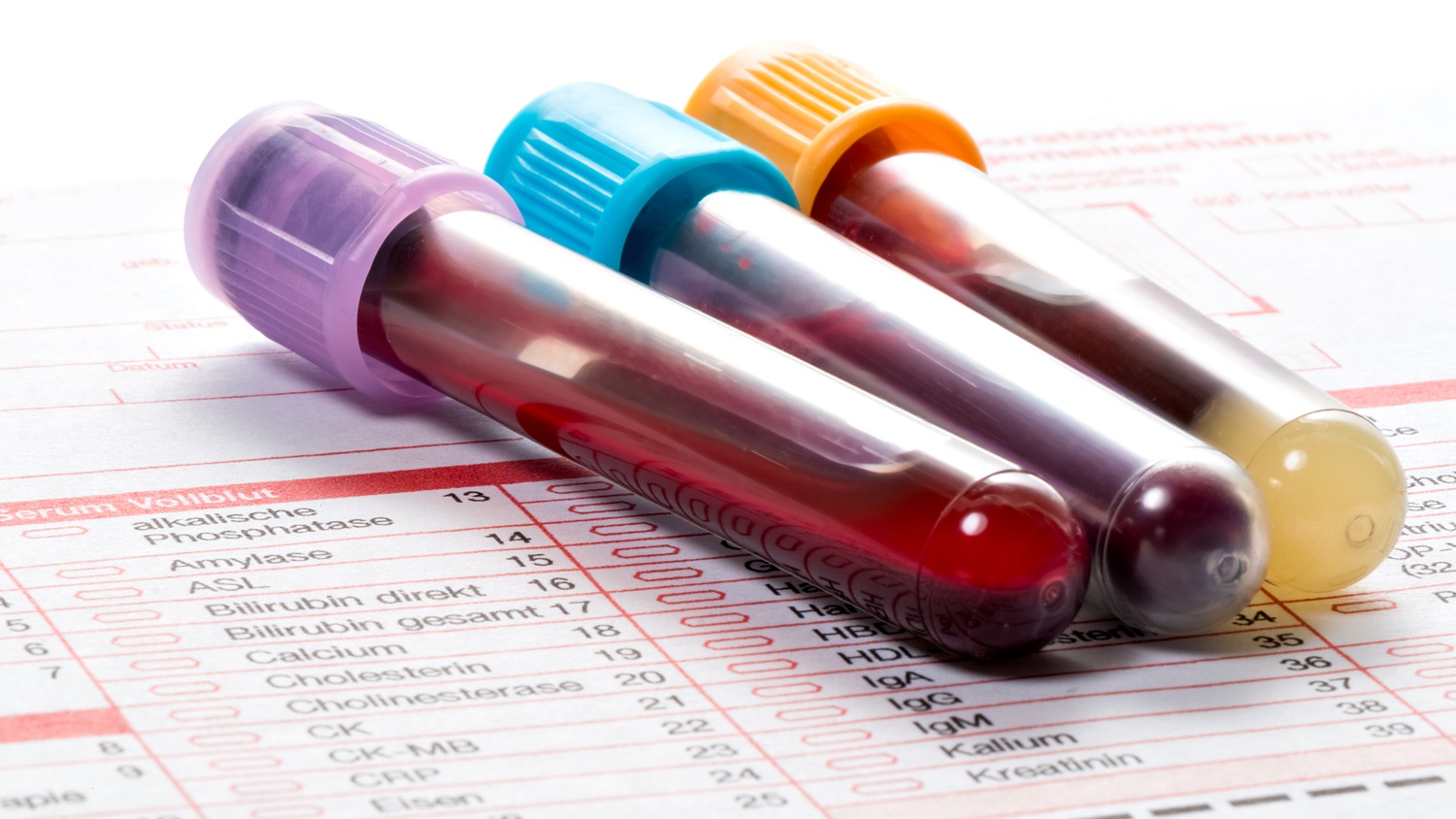 Blood Testing