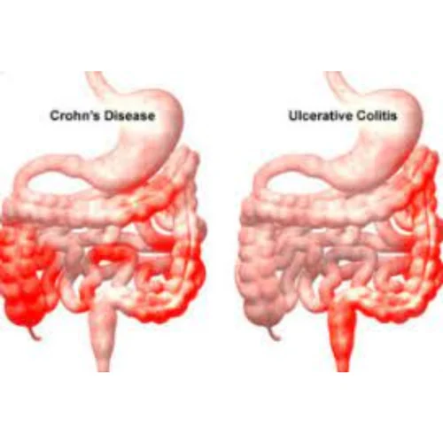 Chronic Diseases Treatment Services