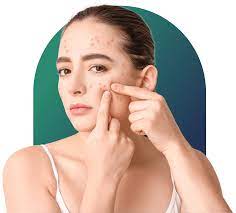 Acne Treatment Services