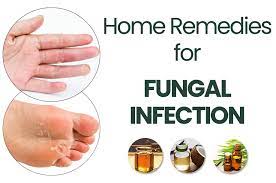 Fungal Infection Treatment