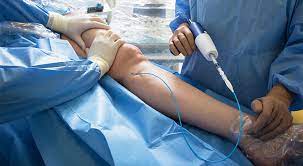 Vascular Surgery