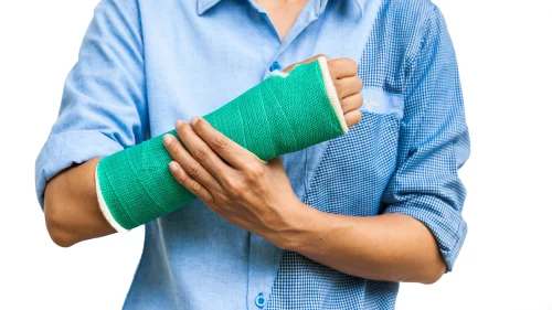 Fractures Treatment Service