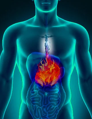 Acidity Treatment Service
