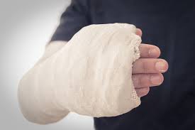 Plaster Of Paris