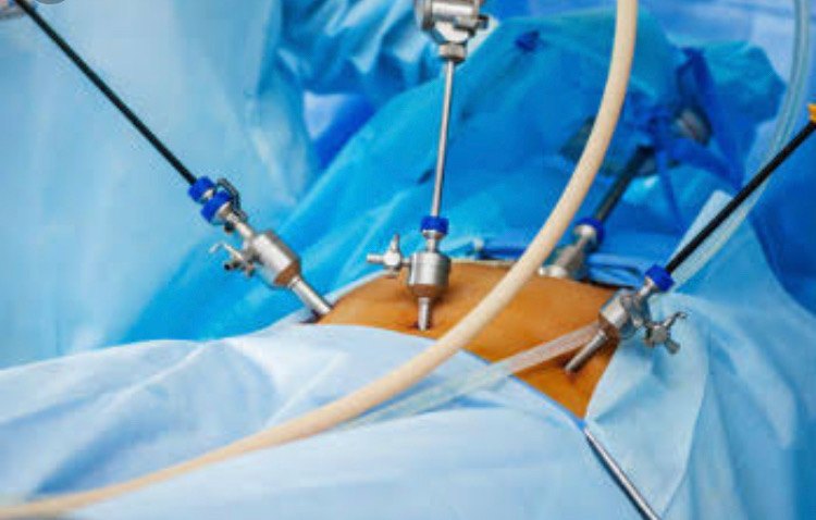 Laparoscopic Surgery Services