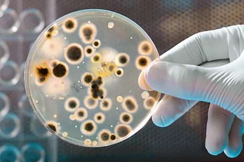 Microbial Analysis