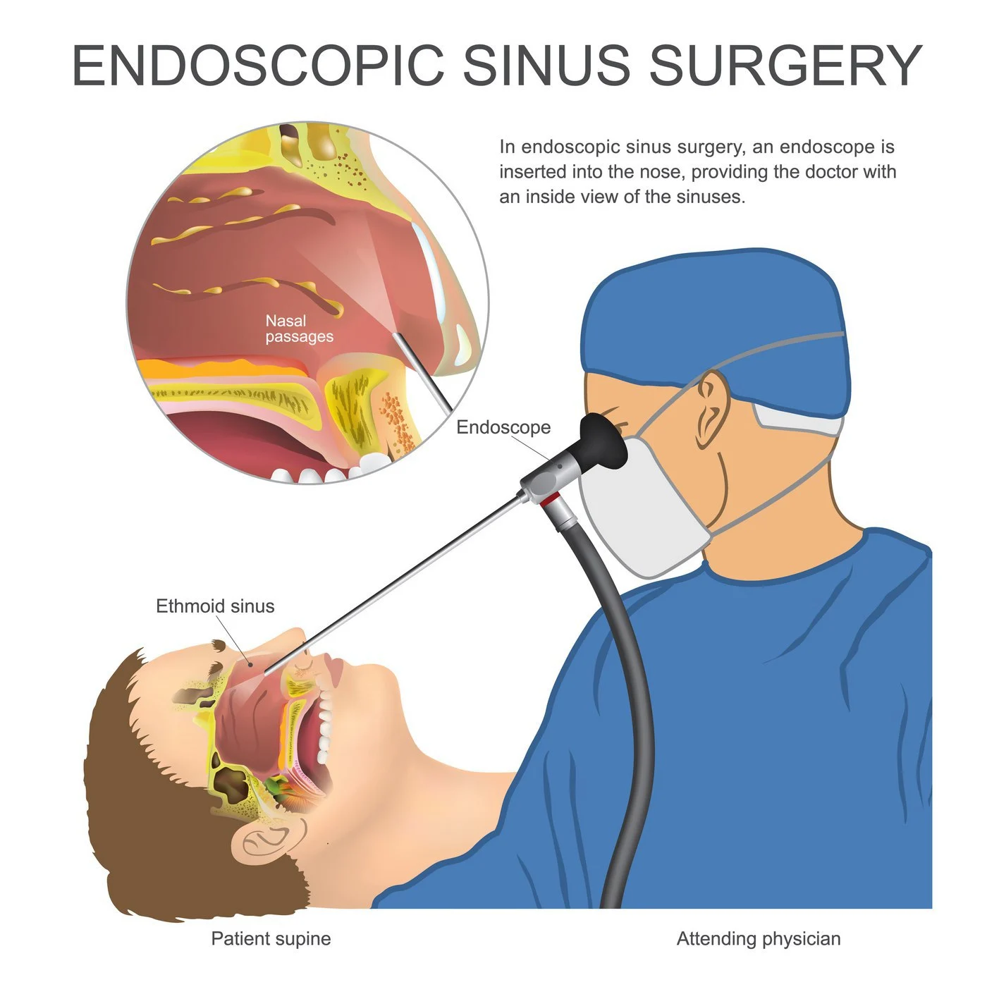 Endoscopic Surgery