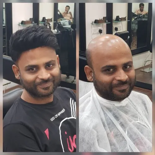 Non Surgical Hair Replacement
