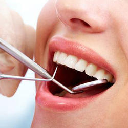 Periodontal Dental Treatment Services
