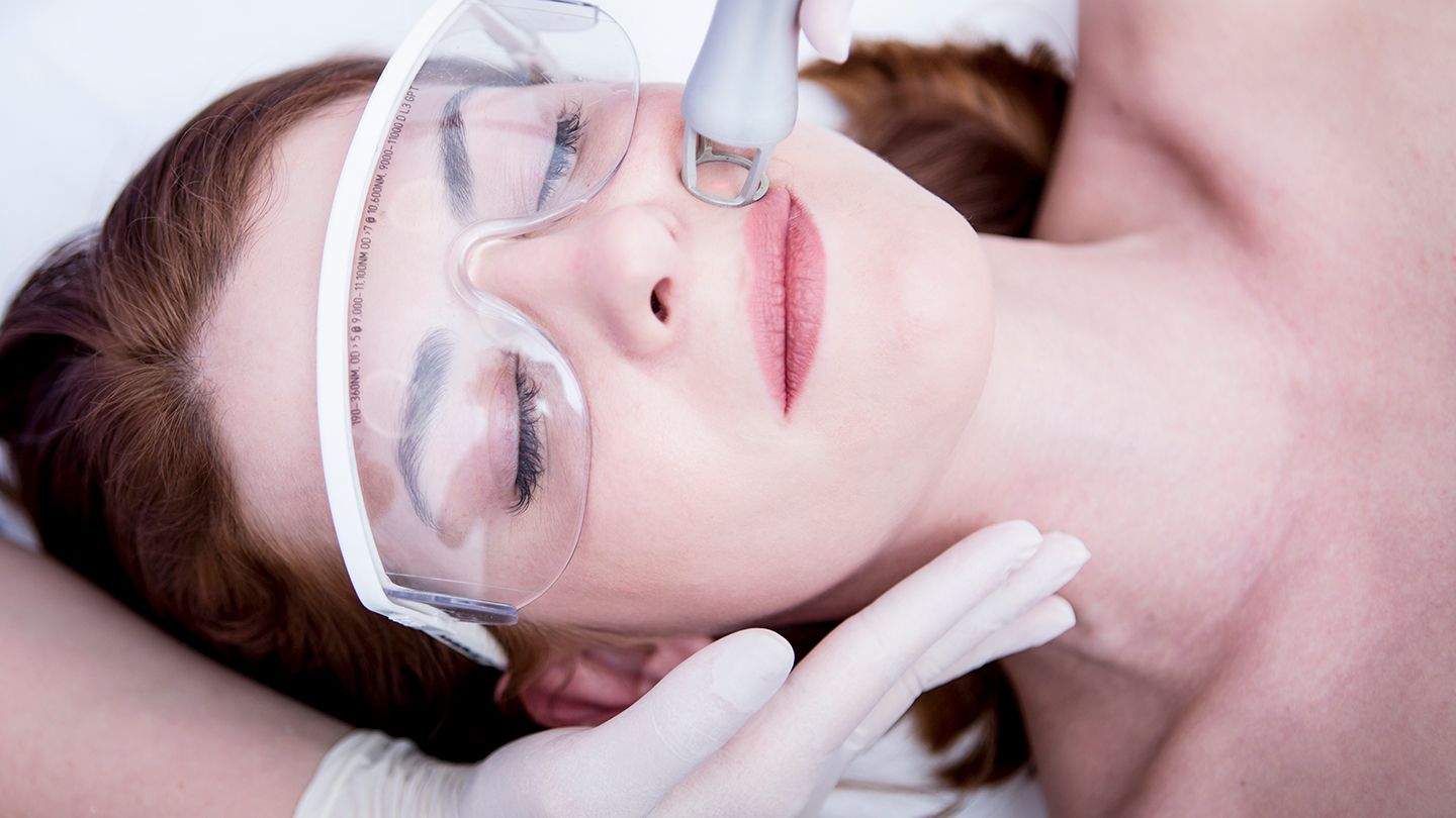 Laser Treatments